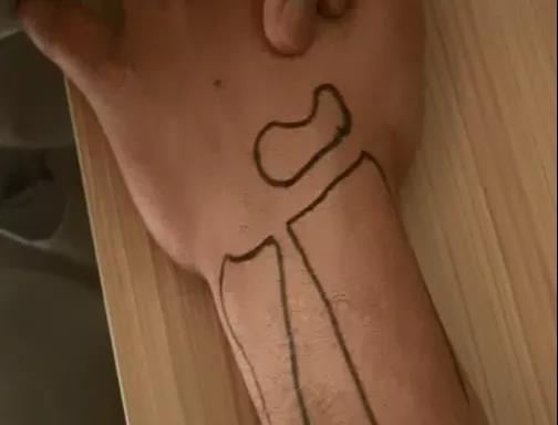 医用几丁糖是什么20种关节腔穿刺技术，你想知道的都在这了！_https://www.jmylbn.com_新闻资讯_第22张