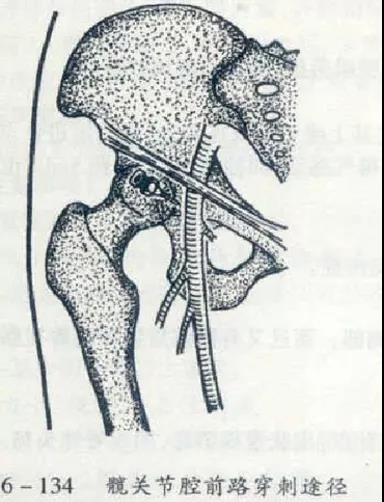医用几丁糖是什么20种关节腔穿刺技术，你想知道的都在这了！_https://www.jmylbn.com_新闻资讯_第9张