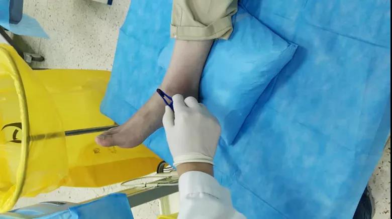 医用几丁糖是什么20种关节腔穿刺技术，你想知道的都在这了！_https://www.jmylbn.com_新闻资讯_第31张