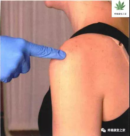 医用几丁糖是什么20种关节腔穿刺技术，你想知道的都在这了！_https://www.jmylbn.com_新闻资讯_第14张