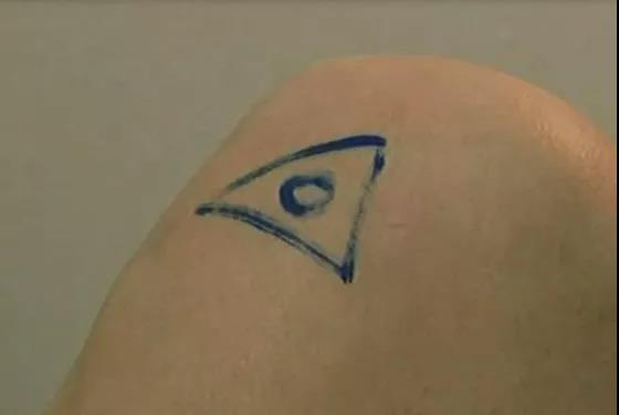 医用几丁糖是什么20种关节腔穿刺技术，你想知道的都在这了！_https://www.jmylbn.com_新闻资讯_第3张