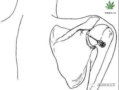 医用几丁糖是什么20种关节腔穿刺技术，你想知道的都在这了！_https://www.jmylbn.com_新闻资讯_第18张